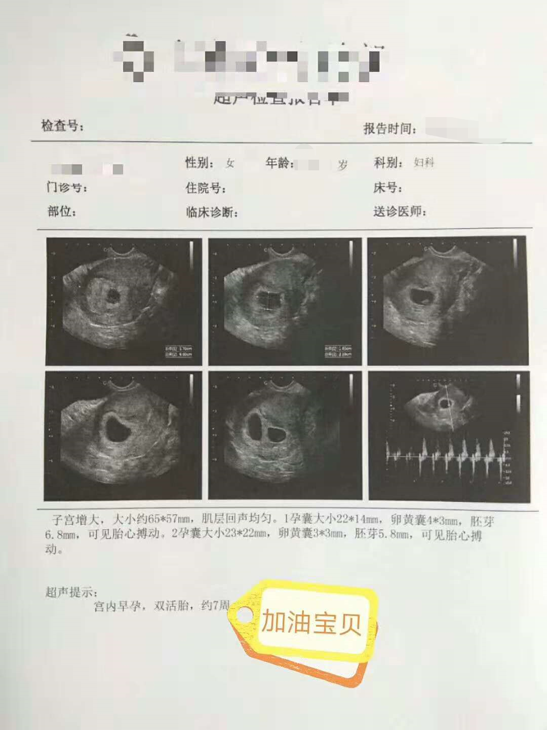 微信图片_20181101104027.png