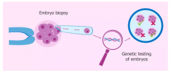 第三代试管婴儿技术能筛查哪些遗传病？