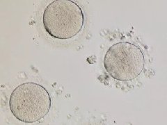  AMH正常，取的却是空卵泡？我该怎么办？